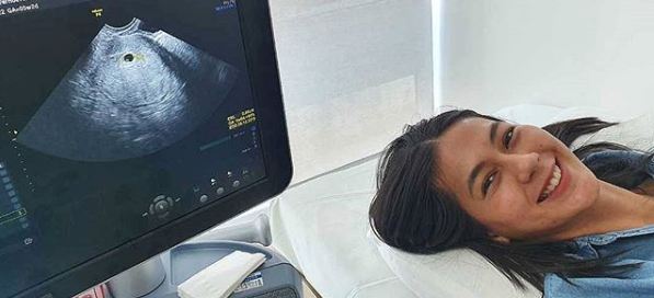 Paula Verhoeven pernah keguguran, curhatan Baim Wong ini pilu