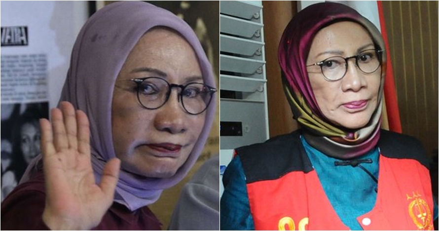Ratna Sarumpaet ternyata sudah jalani empat kali operasi plastik