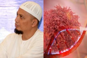 Mengenal penyakit kanker getah bening serta penyebab & gejalanya