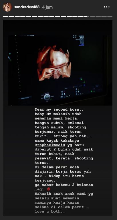 Curhatan Sandra Dewi hamil anak kedua ini bikin haru