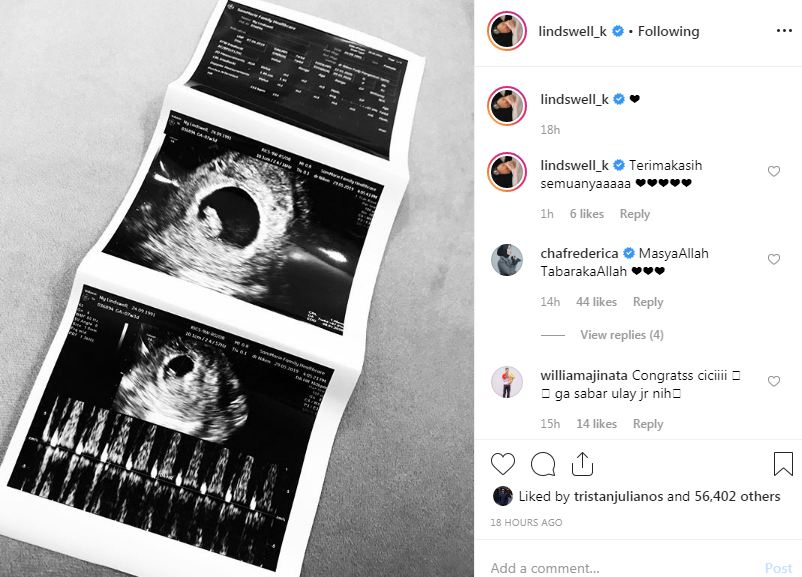 Selamat! Lindswell Kwok hamil anak pertama