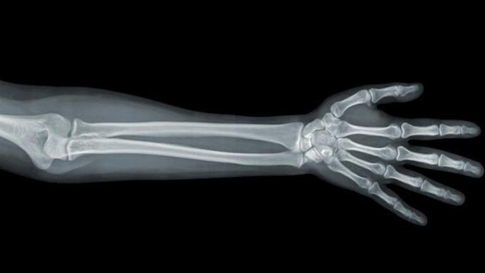 7 Manfaat santan bagi kesehatan, bisa kontrol berat badan