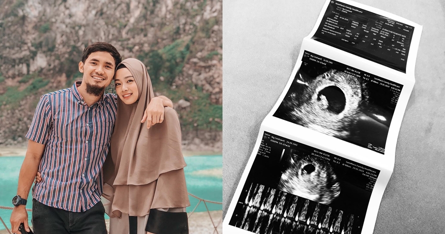Kisah 4 seleb umumkan kehamilan saat Ramadan 2019, jadi kado manis