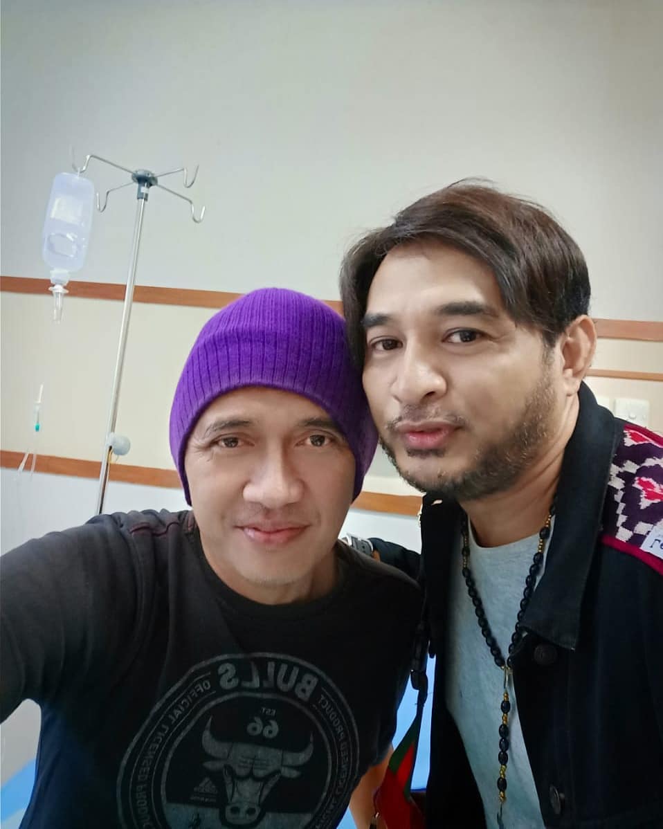 Begini gejala awal Agung Hercules saat terserang kanker otak