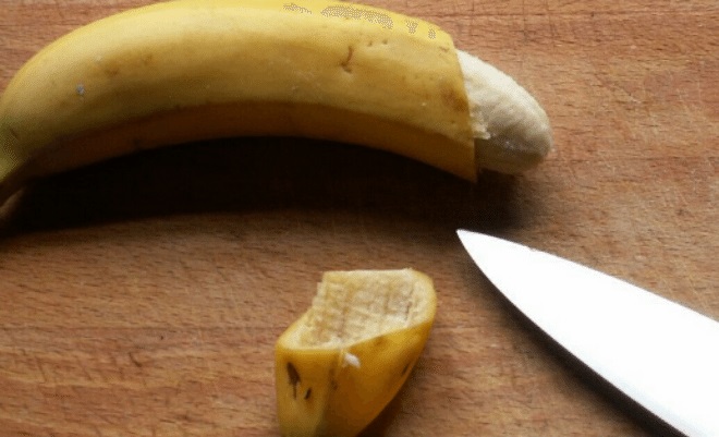 6 Fakta dan risiko sunat saat di usia dewasa