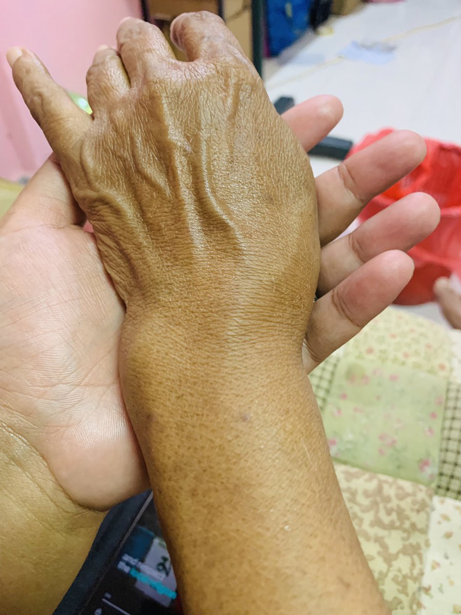 Kisah pilu ibu masak jamuan buat saudara tapi tak ada yang datang