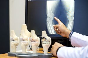 Sering nggak disadari, 7 kebiasaan ini memicu osteoporosis dini