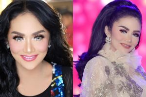 Krisdayanti ungkap biaya operasi plastiknya, capai ribuan dolar