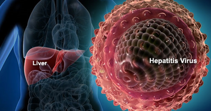 Sembuh dari hepatitis, ternyata pasien bisa terjangkit lagi