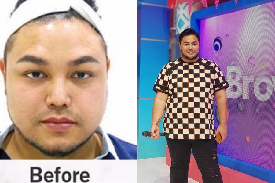 4 Seleb pria ini akui operasi plastik, termasuk Roy Kiyoshi