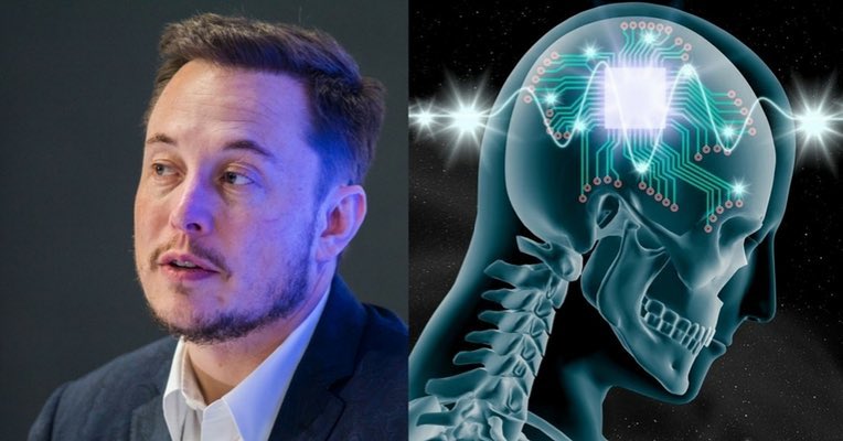 Elon Musk ungkap proyek tanam chip di otak manusia