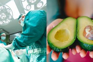 10 Makanan terbaik untuk dikonsumsi setelah operasi