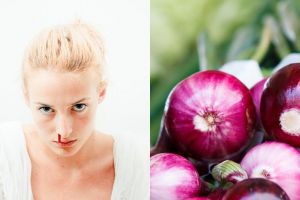 9 Cara menghentikan mimisan, mudah dan efektif