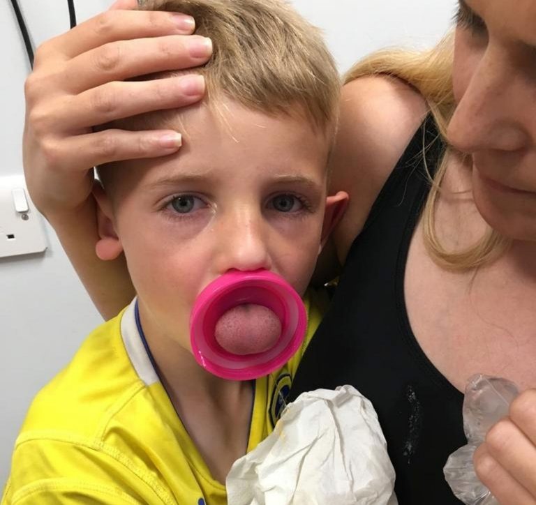 Bocah 6 tahun ini hampir kehilangan lidahnya karena lubang botol