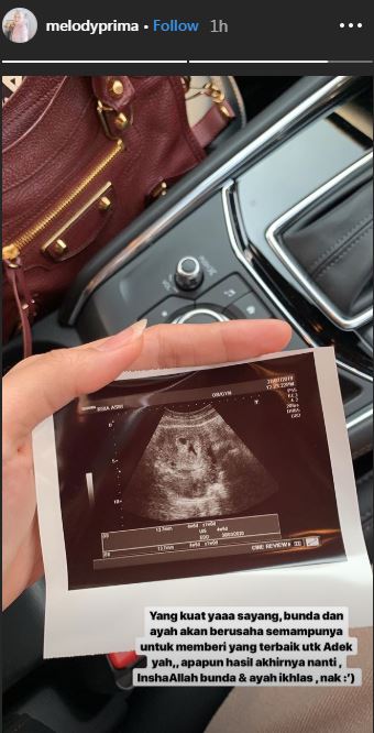 Momen bahagia Melody Prima umumkan kehamilan anak kedua