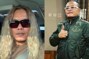 Sule unggah foto masa kecil, perubahan wajahnya jadi sorotan