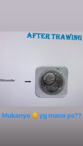 6 Momen Jennifer Jill jalani program bayi tabung, ingin anak cewek