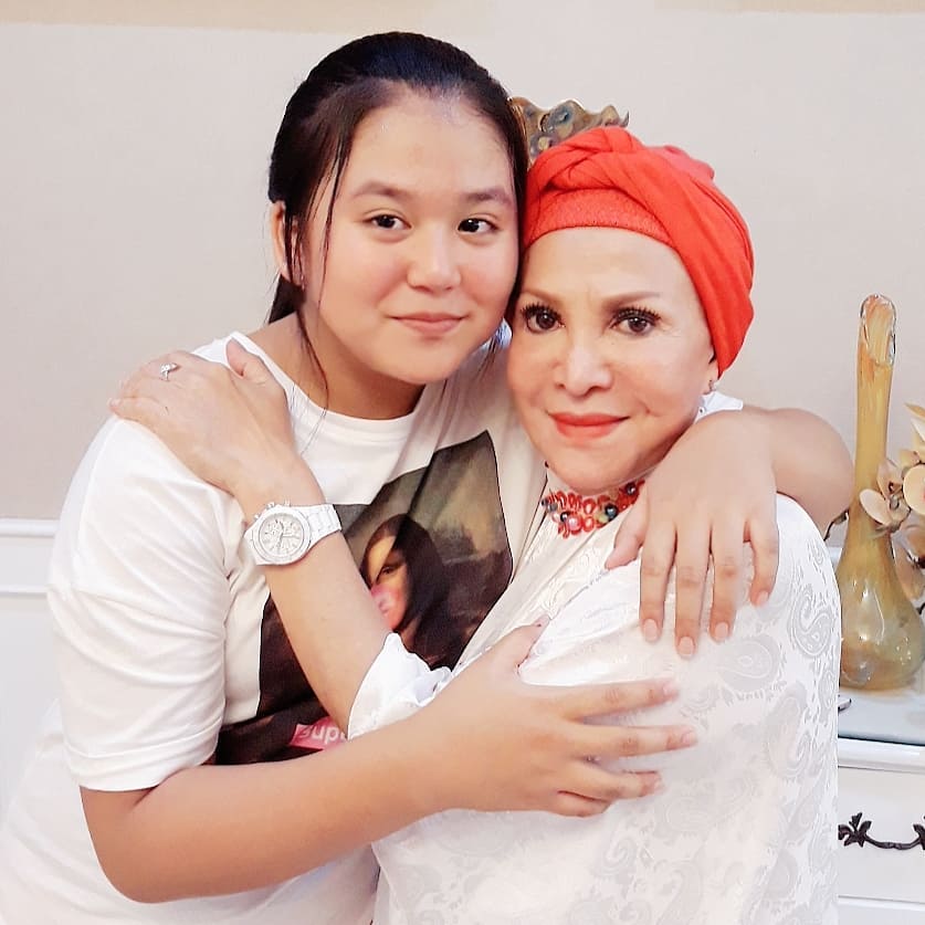 8 Foto terbaru Mpok Atiek, pernah 16 kali operasi pengangkatan silikon