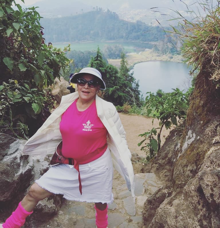 8 Foto terbaru Mpok Atiek, pernah 16 kali operasi pengangkatan silikon