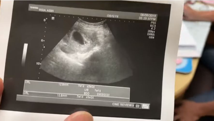 Baru 8 bulan lahiran, istri Ricky Harun umumkan hamil anak ke-4