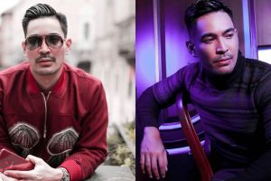 Robby Purba ungkap bagian tubuhnya yang disuntik botoks