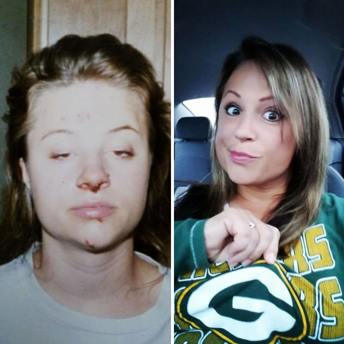 11 Potret perubahan wajah sebelum & sesudah sembuh dari narkoba