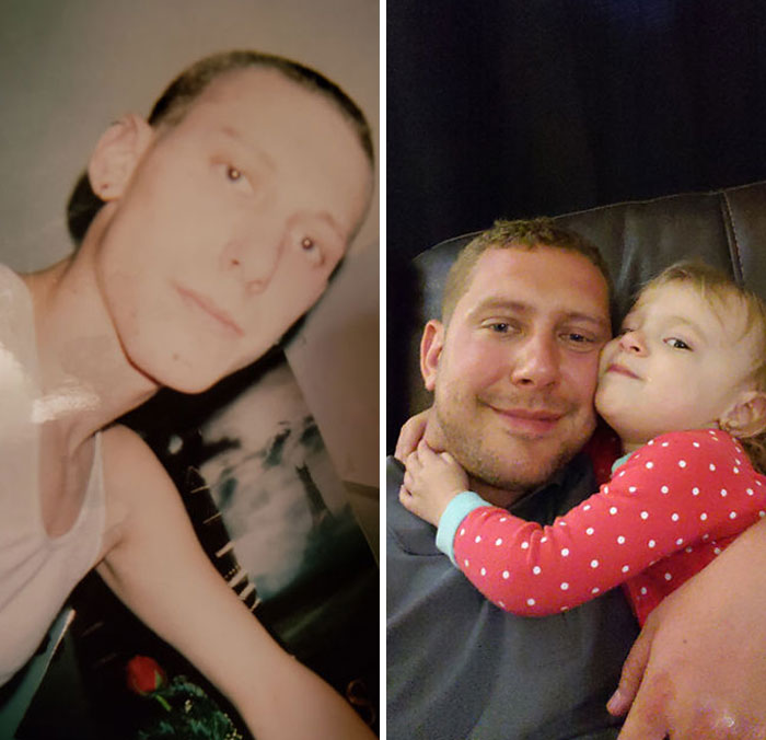 11 Potret perubahan wajah sebelum & sesudah sembuh dari narkoba