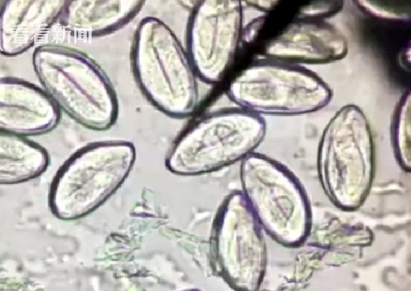 Makan raw fish bertahun-tahun, nasib pria ini berujung tragis