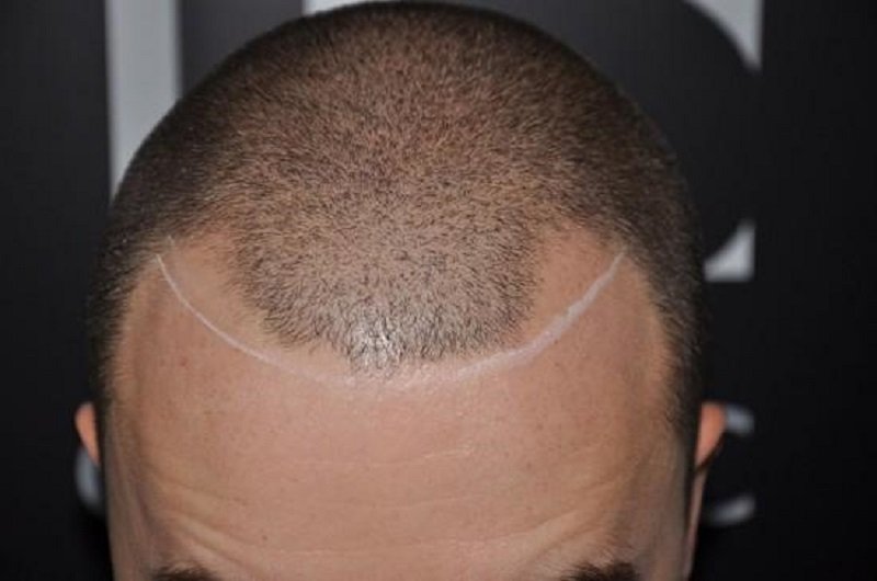 10 Kelakuan nyeleneh orang botak ini bikin geleng kepala