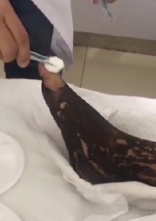 Tiru adegan film hisap bisa ular, wanita ini dilarikan ke RS