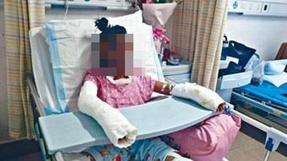 Tiru cara memasak popcorn di YouTube, remaja ini alami hal mengerikan