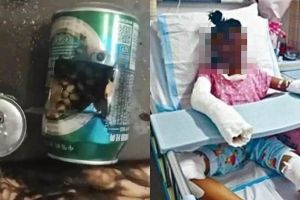 Tiru cara memasak popcorn di YouTube, remaja ini alami hal mengerikan