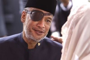 Gejala glaukoma penyakit mata yang diderita Thareq Kemal Habibie