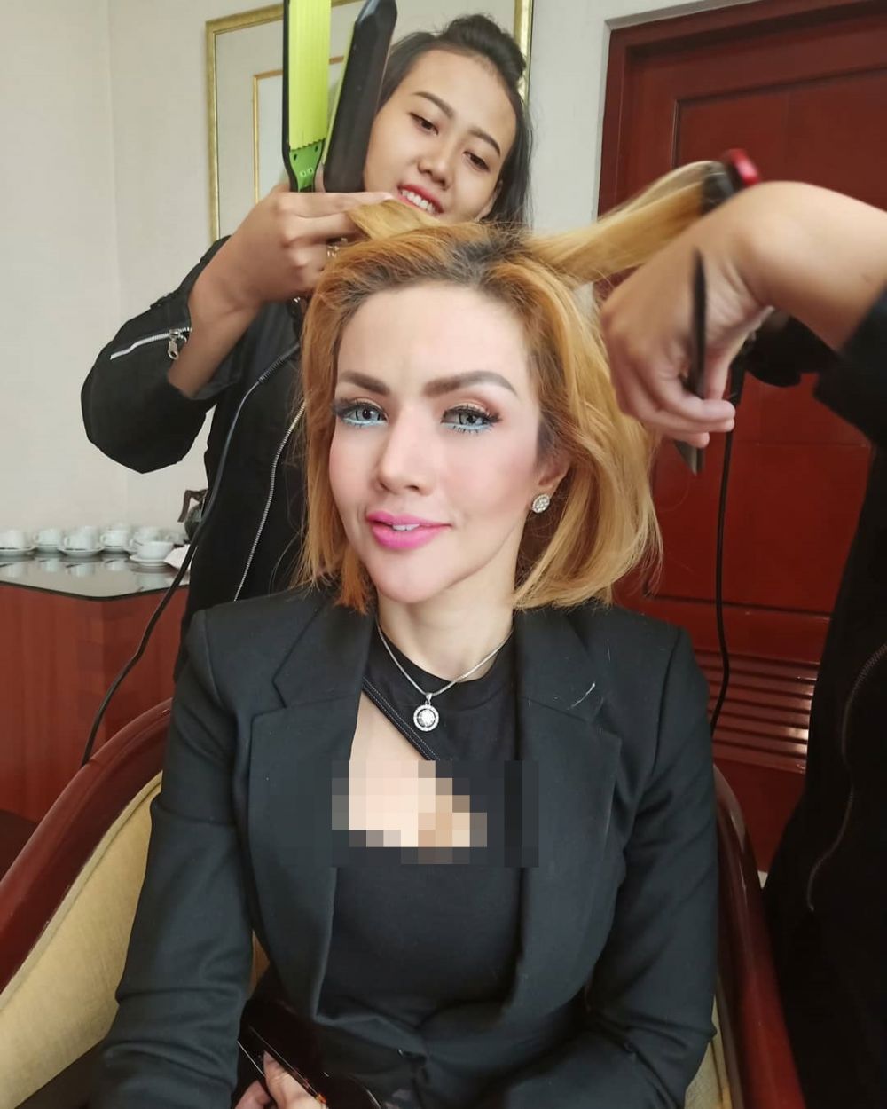 Demi cantik, 5 seleb ini dikabarkan pernah lakukan suntik putih