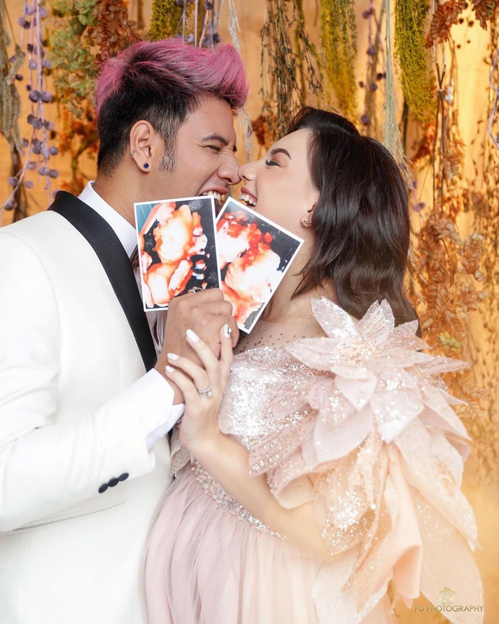 6 Potret maternity Irish Bella & Ammar Zoni pamer foto si kembar