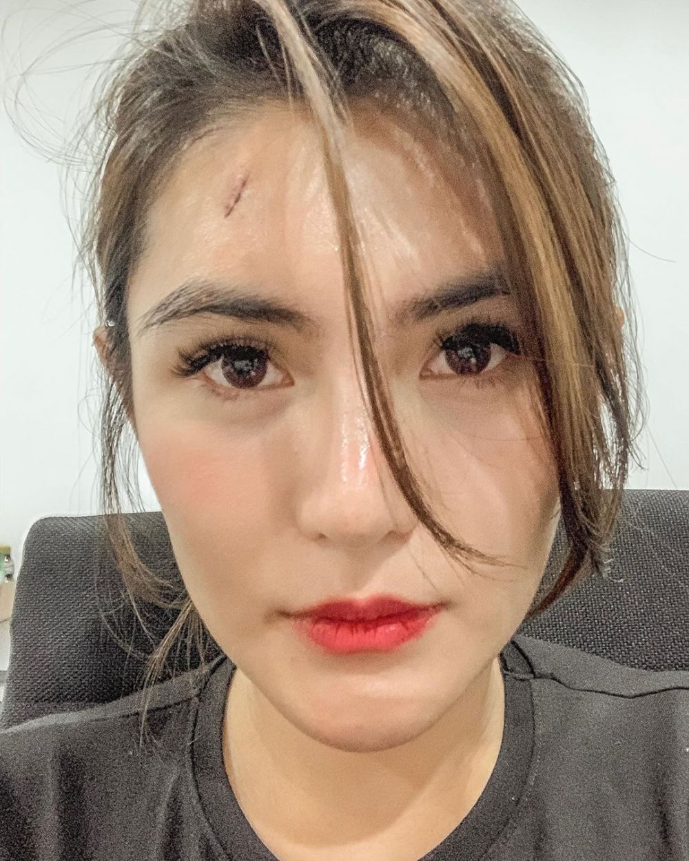Angela Lee ngaku diganggu makhluk gaib, cedera hingga dioperasi