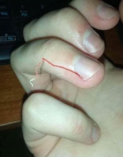 7 Penampakan tangan dan kaki tak biasa ini bikin ngilu