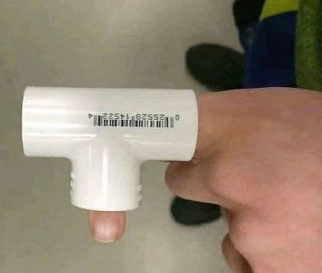 7 Penampakan tangan dan kaki tak biasa ini bikin ngilu