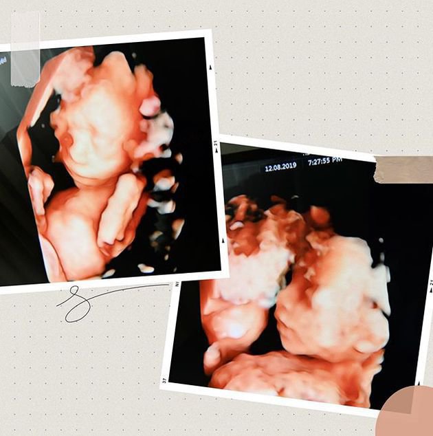 7 Momen kenangan manis Irish Bella & Ammar dengan bayi kembarnya