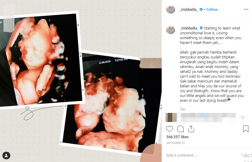 5 Pesan menyentuh Ammar Zoni & Irish Bella untuk bayi kembarnya