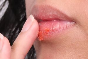 5 Cara menggunakan masker bibir yang benar, hasilnya optimal