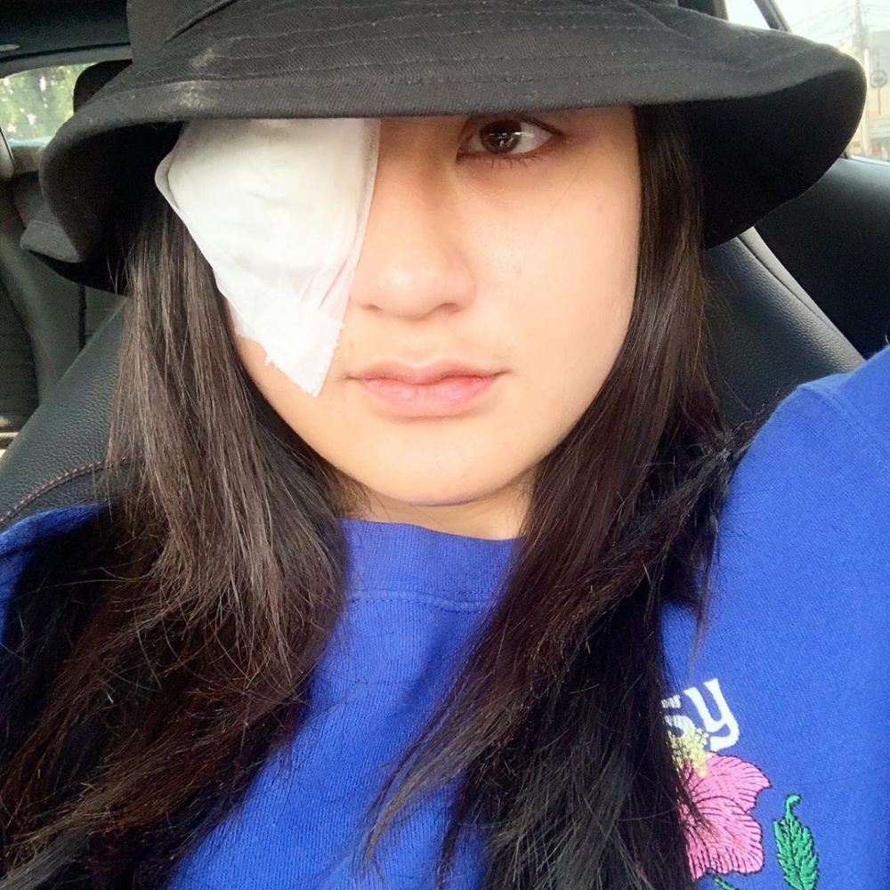 Kisah ngeri Salshabilla Adriani, nyaris buta karena softlens