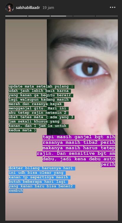 Kisah ngeri Salshabilla Adriani, nyaris buta karena softlens