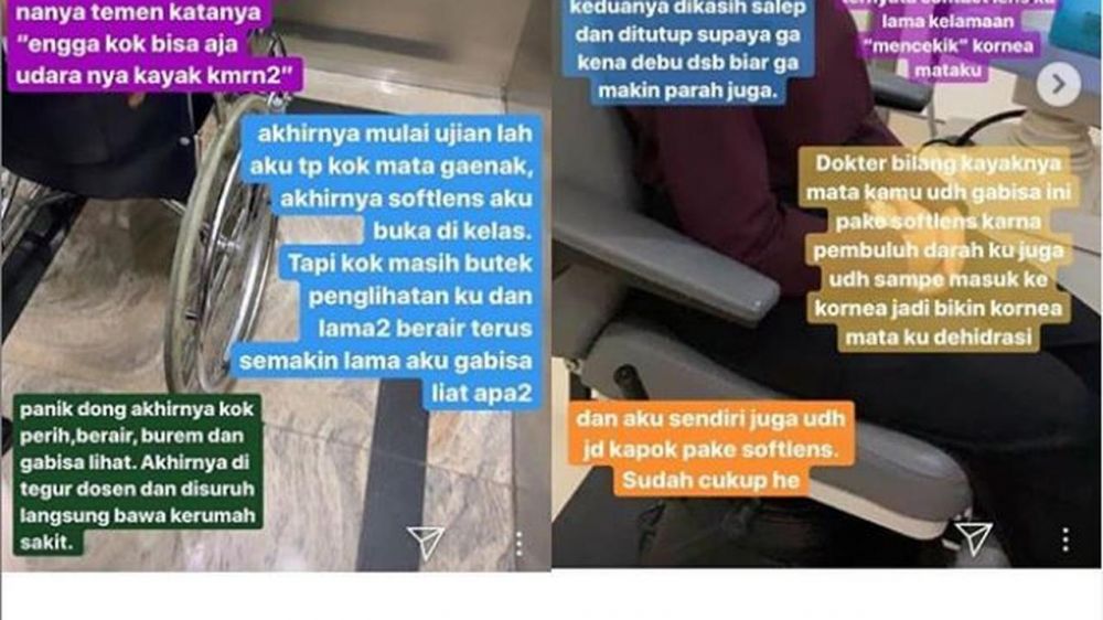 Kisah ngeri Salshabilla Adriani, nyaris buta karena softlens