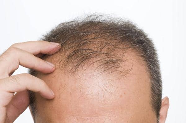 13 Manfaat minyak zaitun untuk rambut & cara menggunakannya