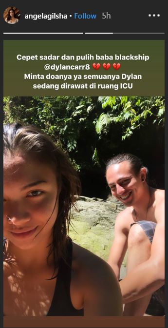 Kondisi Dylan Carr 'Anak Langit' usai alami kecelakaan