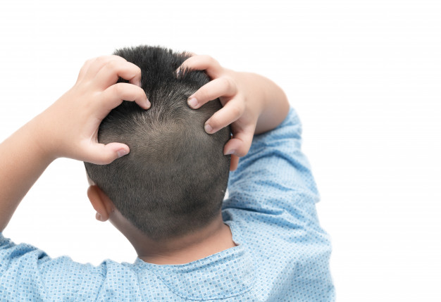 10 Penyebab rambut rontok pada anak dan cara mengatasinya