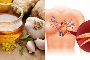 8 Manfaat bawang putih dan madu untuk tubuh & cara pakainya