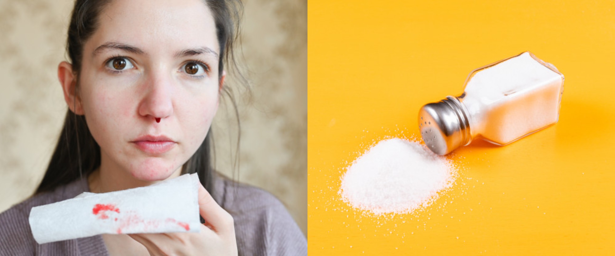 15 Cara mengatasi mimisan mudah dan alami, lengkap dengan penyebabnya