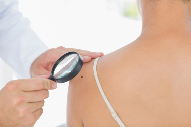 11 Jenis penyakit kulit dan cara alami mengatasinya